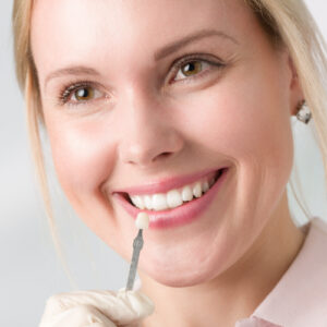 veneers
